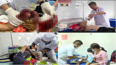 Cảnh báo tình trạng thanh thiếu niên tự chế pháo nổ trong những ngày giáp Tết Nguyên Đán năm 2026